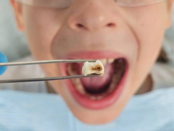 Best Emergency Dentist for Knocked-Out Tooth in Munroe Falls, OH